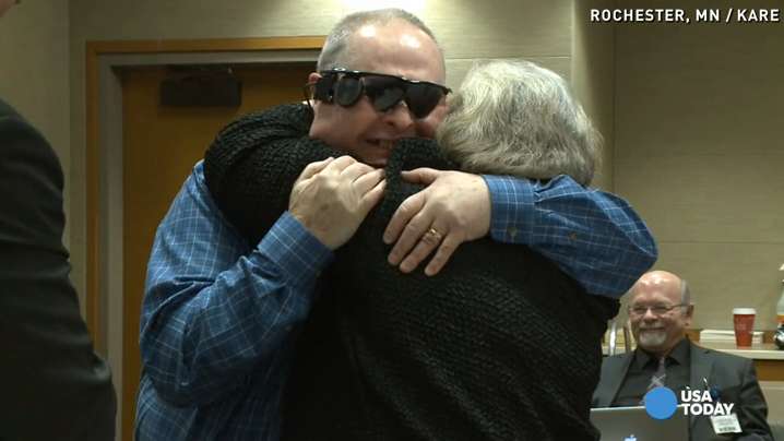 Man Gets Bionic Eye Sees Wife For First Time In A Decade 