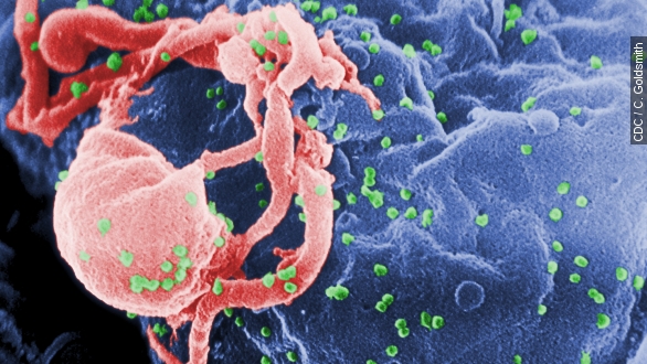 Hiv Outbreak Prompts Public Health Emergency In Indiana