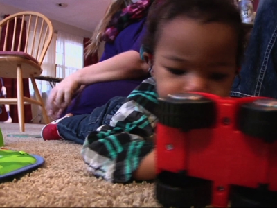 Wisc Mother Shares Experience with Microcephaly