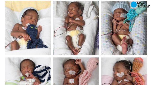 Sextuplets Born After 17 Years Of Trying For 1