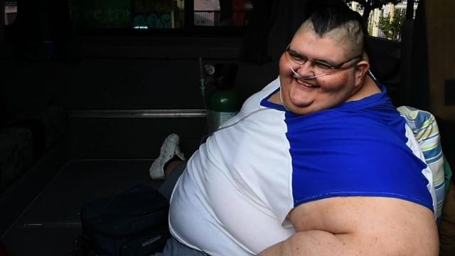 Fattest Man In The World Prepares For Surgery In Mexico 