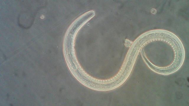 Couple contract hookworms while on vacation in Dominican Republic